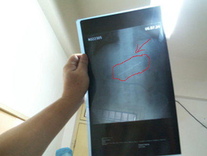 ͼƬ��������´��ڴ򿪲鿴